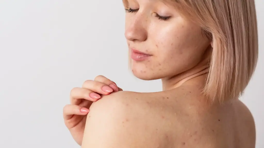 clinica tufet herpes