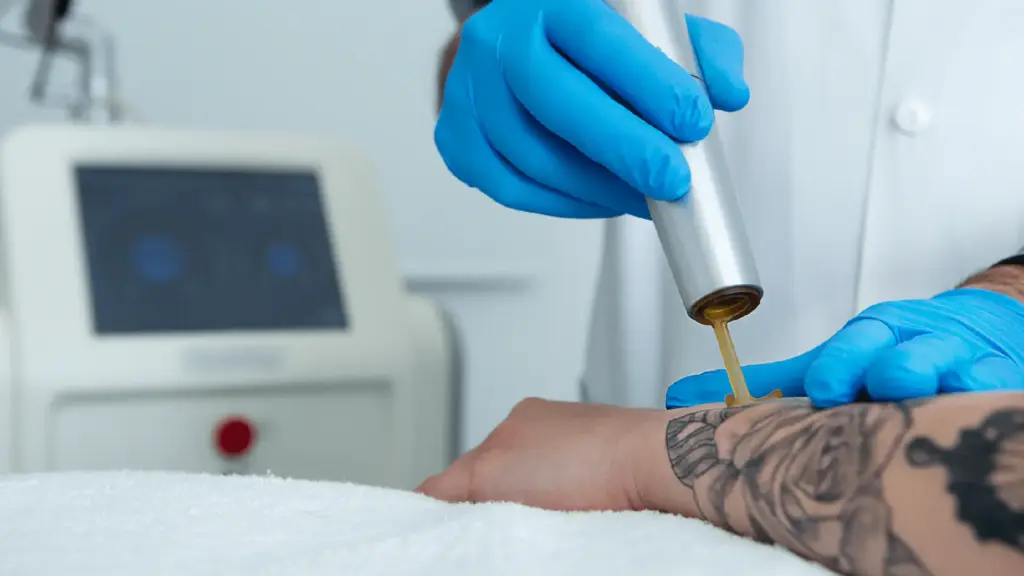 CLINICA TUFET eliminación de tatuaje clinica tufet barcelona