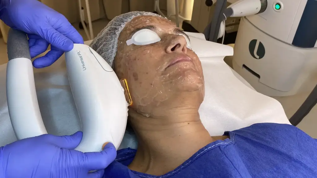 tufet IPL clinic