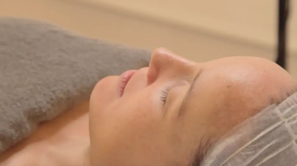 tratamiento para melasma