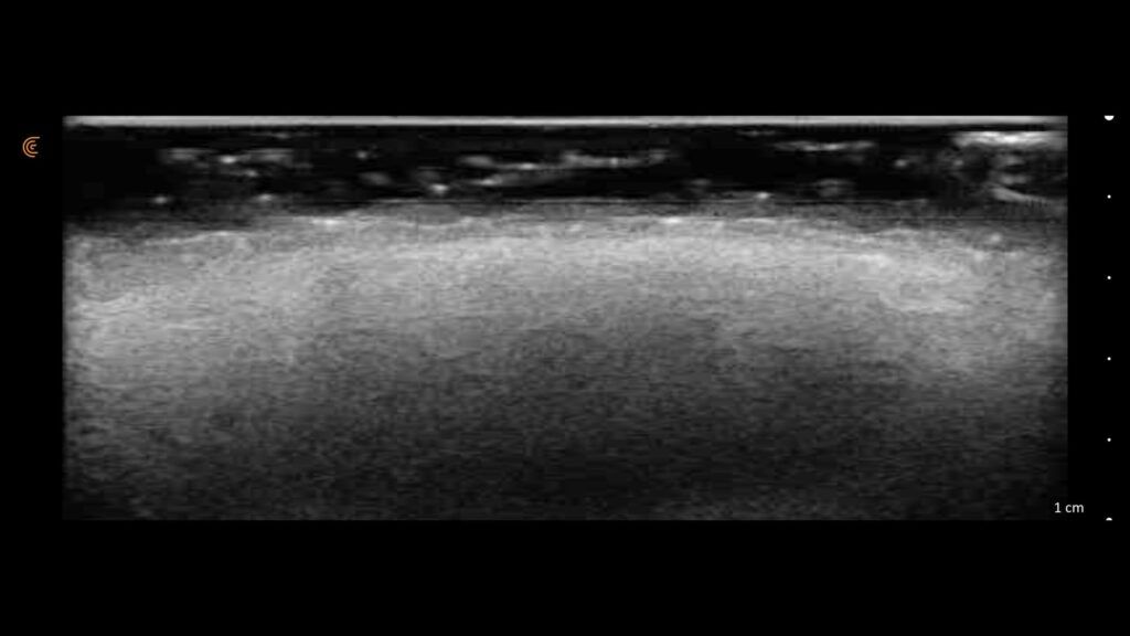 ultrasound by IA NESAI