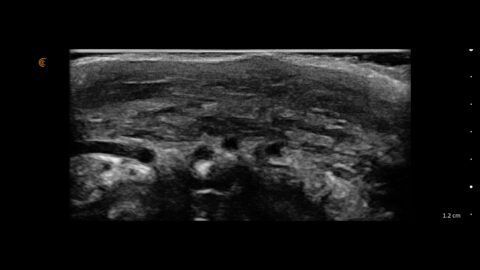 ultrasound by IA NESAI