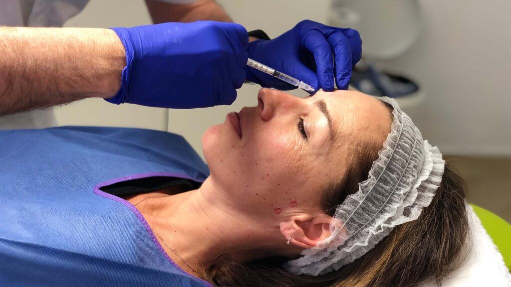 botulinum toxin treatment